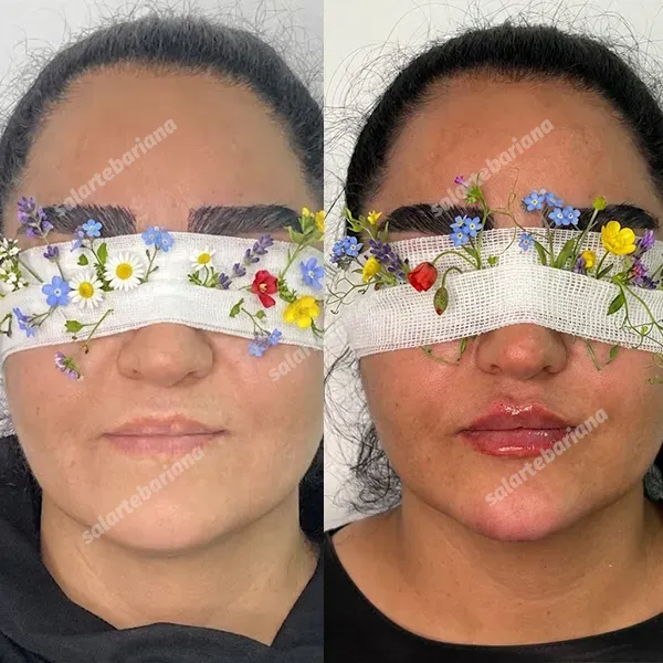 Facial Aesthetics iran